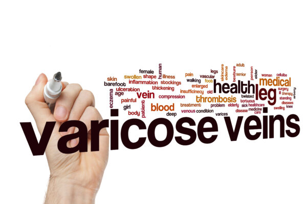 Ενδοφλεβικό Laser και Σκληροθεραπεία Αφρού για κιρσούς»